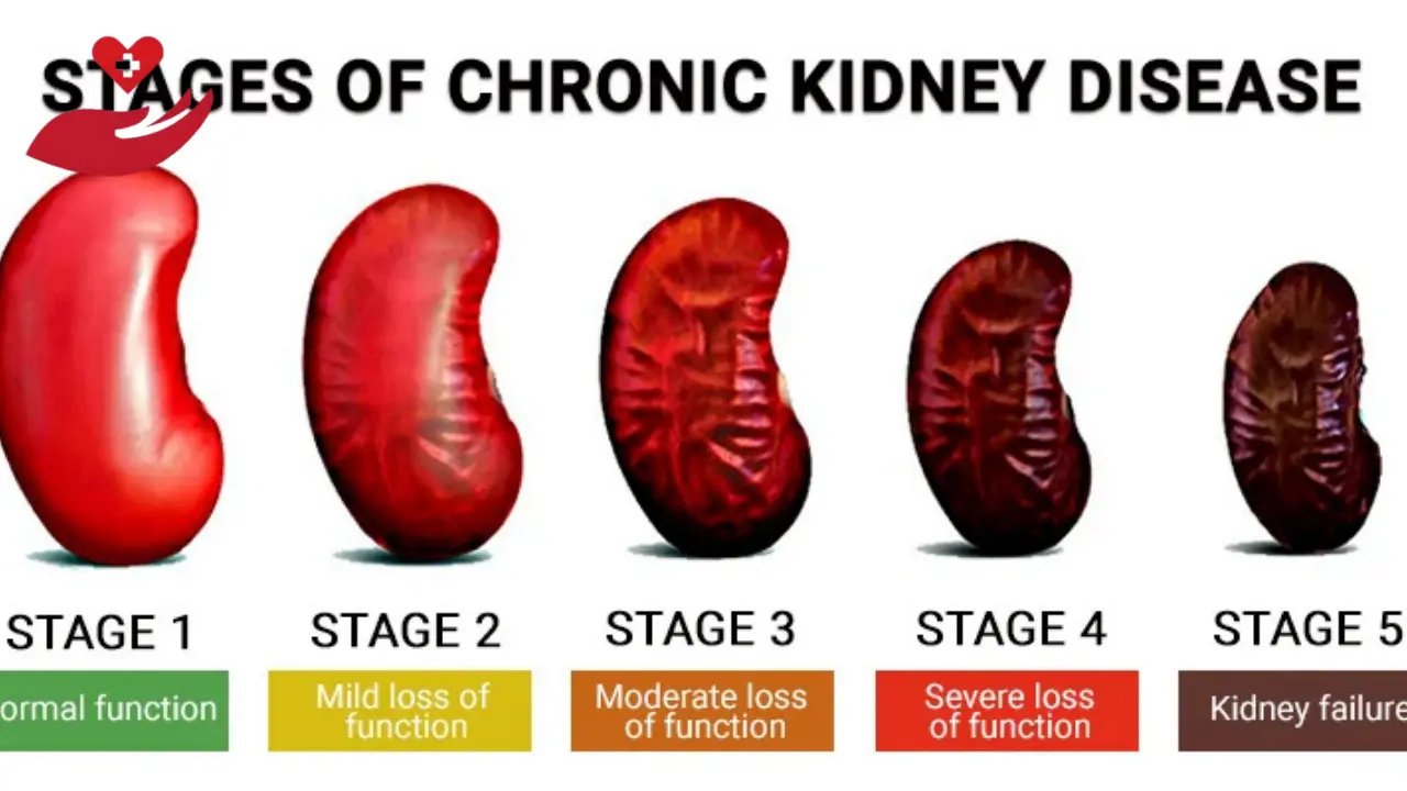 How Long Does It Take To Die From Kidney Failure Without Dialysis?