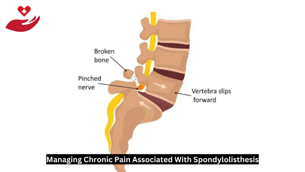 Spondylolisthesis