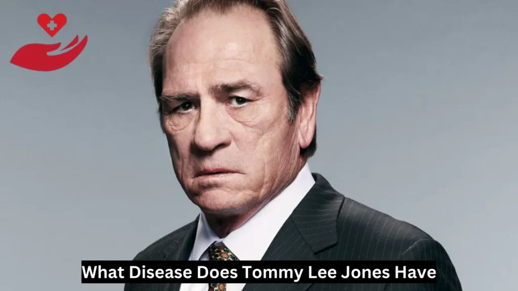 What Disease Does Tommy Lee Jones Have