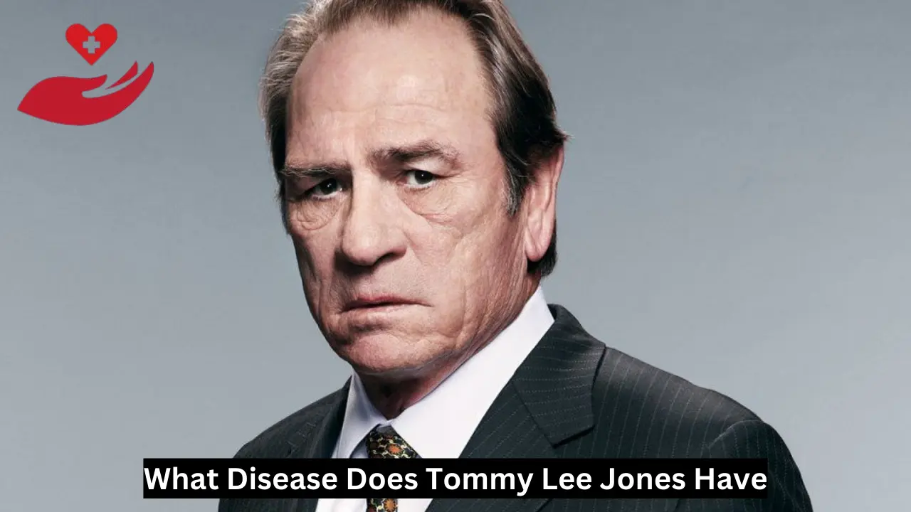 What Disease Does Tommy Lee Jones Have? Health Gossips